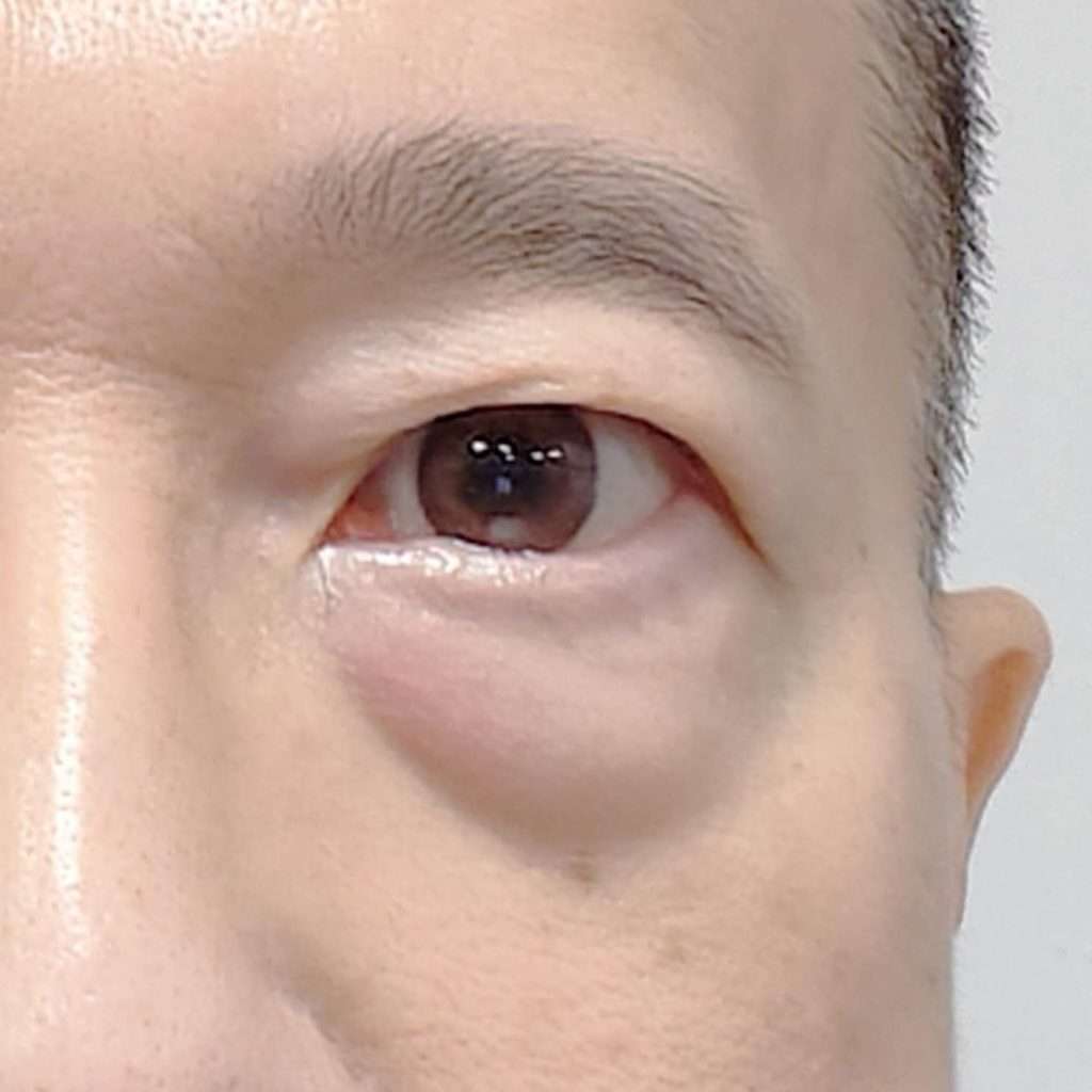 Two Of A Kind - Dewed colored lenses